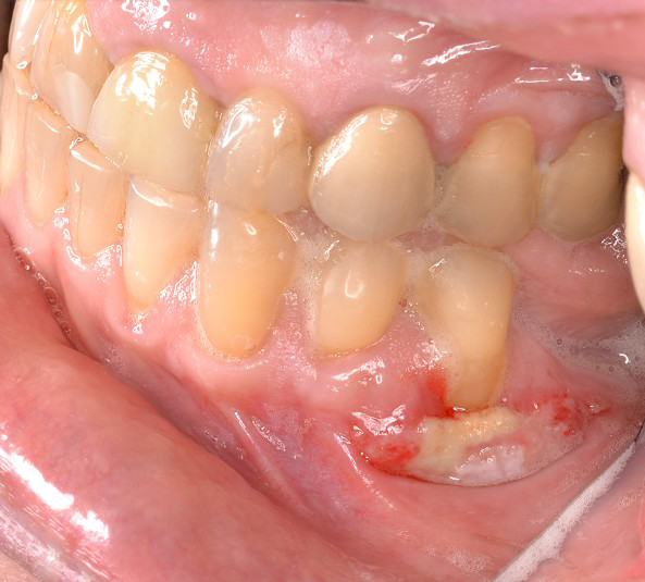 Les parasites les plus terribles pour la personne de la photo