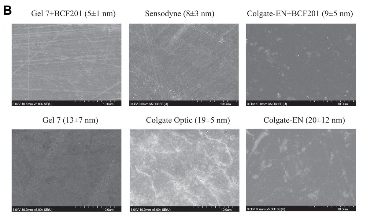 figure 5 B- Scanning electron microscope images of representative samples of enamel